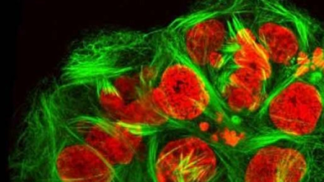 Cellule impazzite causano il cancro 