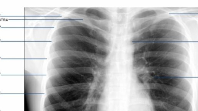 polmoni corpo umano inquinamento