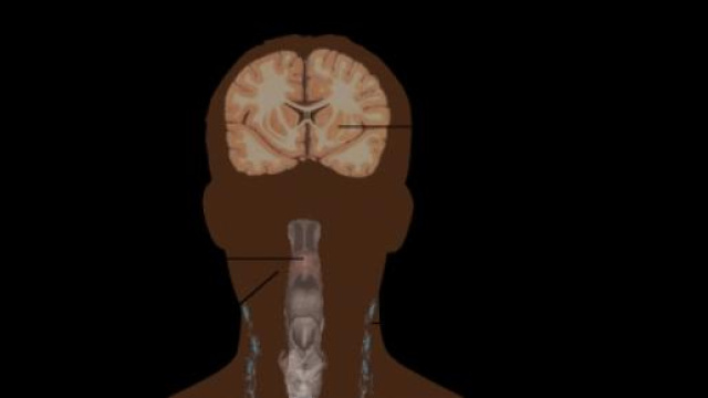 scoperta sostanza anti AIDS