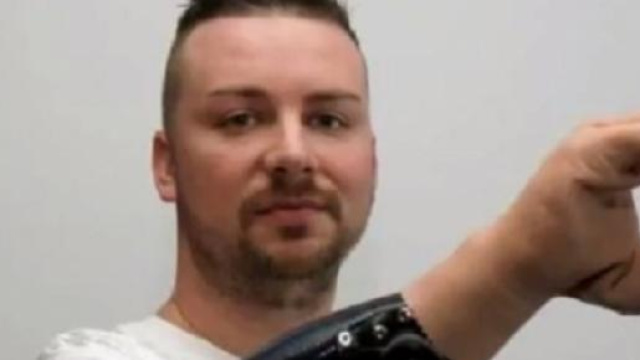 La mano bionica che si muove col pensiero