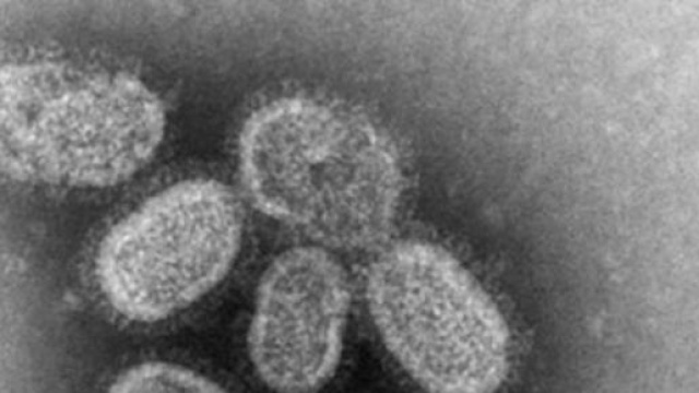 Influenza 2015, quali potrebbero essere le cause