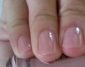 Unhas fracas e quebradiças: Culpa do esmalte?