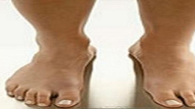 Allarme anoressia e bulimia