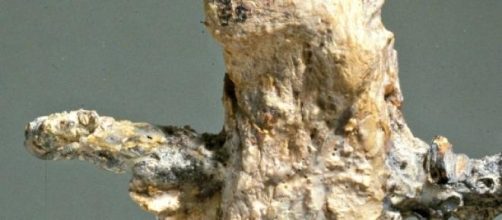 Huesos del tal&oacute;n derecho del crucificado Yeochanan