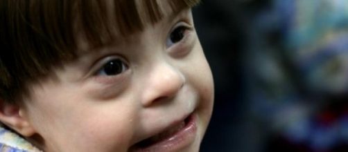 Ni&ntilde;o con S&iacute;ndrome de Down