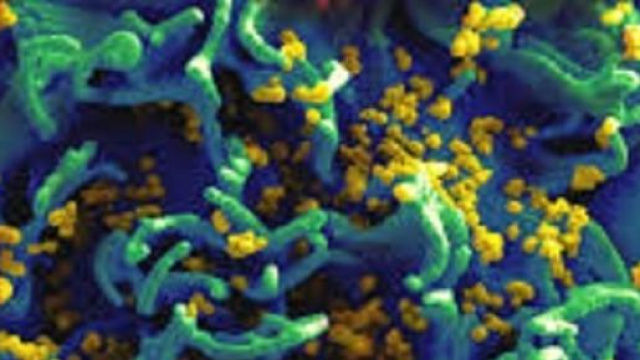 Scoperte le 'tane' dell'Hiv nelle cellule umane