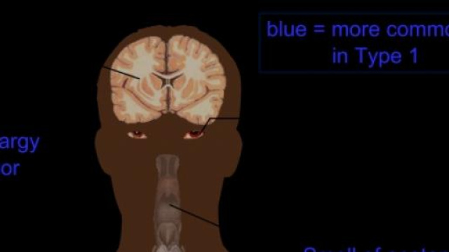 Cancro al seno e diabete: c'&egrave; una connessione