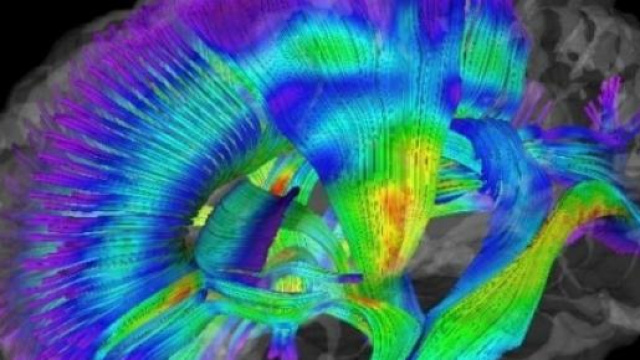 Neuroimaging cerebrale di Jason Wolff, PhD 