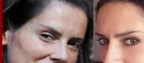 Adriana Barrientos se oper&oacute; la nariz