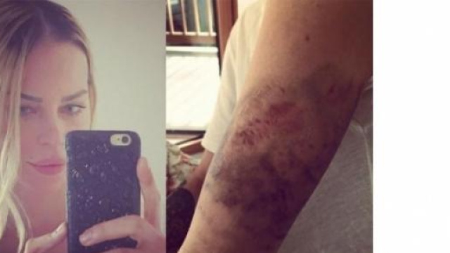 Nina Moric smentisce il tentato suicidio.