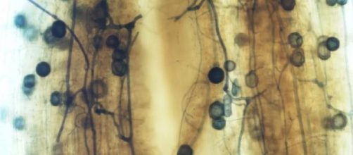 Esporos intraradiculares de R. intraradices