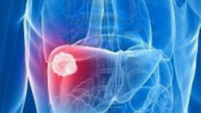 La cura definitiva per l'epatite C