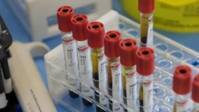 Lo screening &egrave; fondamentale nella lotta al cancro.