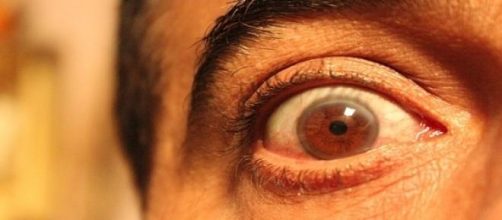 Los ojos ciegos bien abiertos