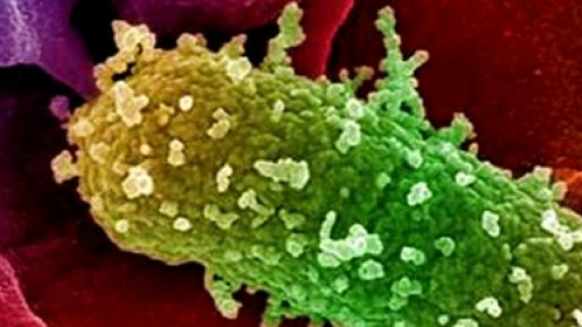  Escherichia coli fra i pi&ugrave; insidiosi e resistenti