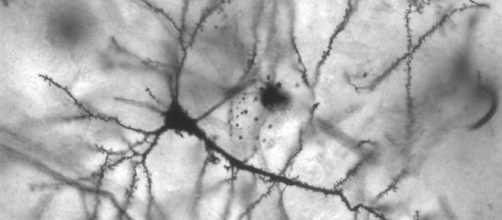 Detalle de una red neuronal