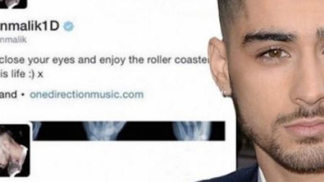 Zayn Malik ha eliminato gli One Direction