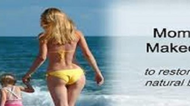 Locandina pubblicitaria del Mommy makeover.