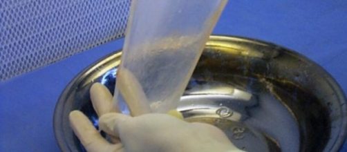 7766 personas esperan ser trasplantados