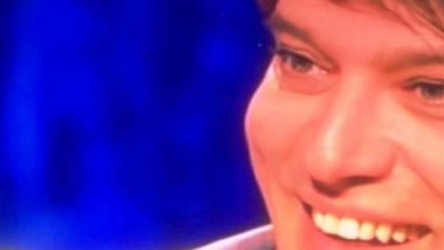 Gabriel Garko cede al 'ritocchino'