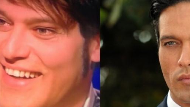 Il volto di Gabriel Garko fa discutere i social.