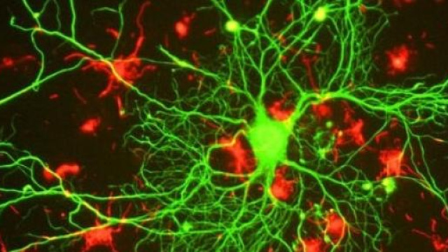 Neurone attaccato da cellule immunitarie 