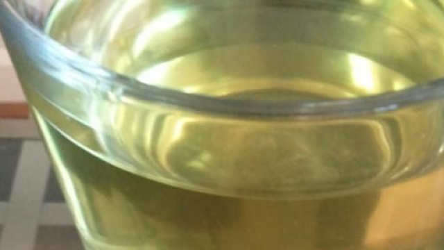 Urinoth&eacute;rapie se soiigner par l urine