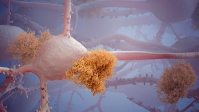 Ricostruzione 3D di neurone e placche amiloidi