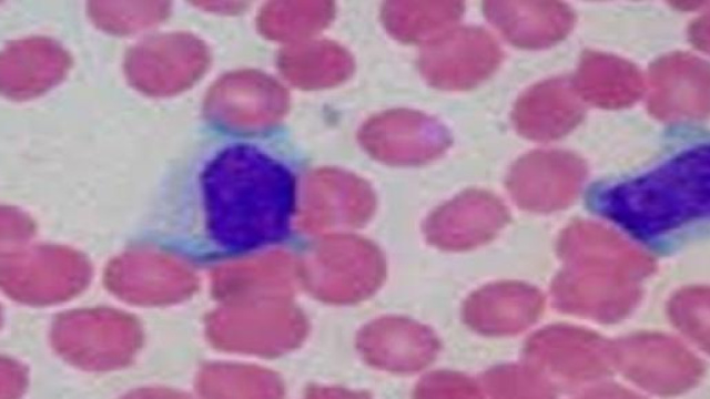 Test sangue e saliva per diagnosticare cancro 