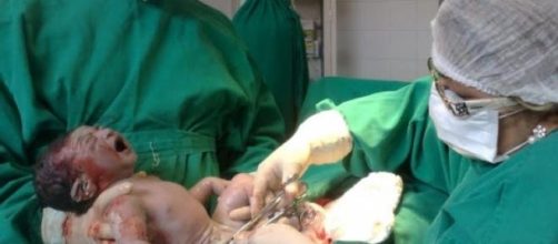 Erro m&eacute;dico na hora do parto