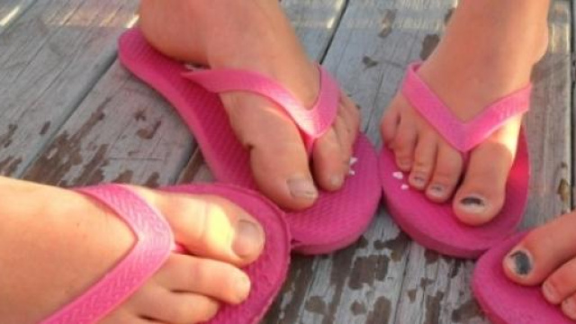 Le infradito fanno male ai piedi