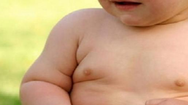 Obesit&agrave; infantile, un grande problema.