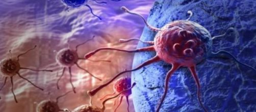 Nivolumab approved in the UK to treat lung cancer.