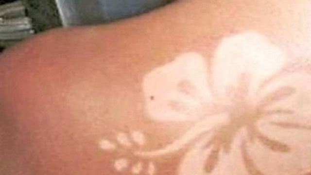 Sunburn, il metodo per fare tatuaggi con il sole