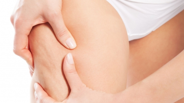 Cellulite: ecco i consigli giusti per combatterla