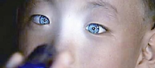 Nong Youhui o menino dos Olhos de Gato