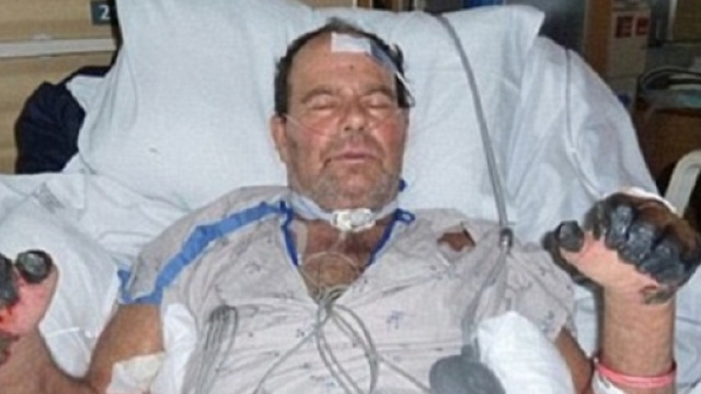 Uomo muore di peste bubbonica negli Usa