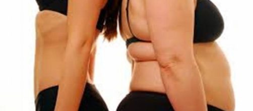 Antes de depois de um tratamento de obesidade.