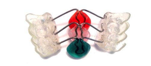 Adelgazar con DentaSlim-Up, aparato bucal