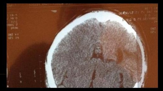La radiografia col volto di Ges&ugrave;