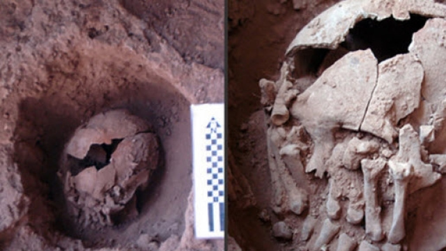 Cranio decapitato con mani che coprono gli occhi
