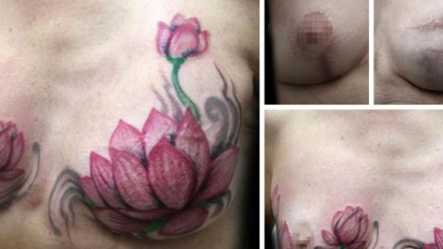 Tattoo che copre cicatrici, Flavia Carvalho