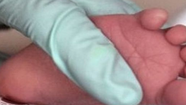 Neonati a rischio col virus Zika.