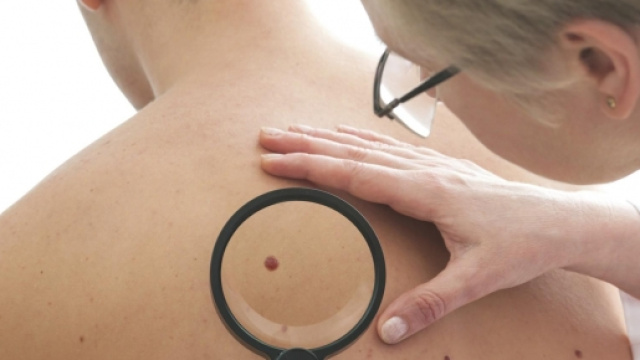 Visite dermatologiche gratuite a Salerno