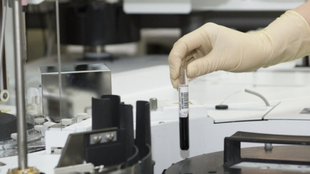 Zika virus e sperimentazione genetica