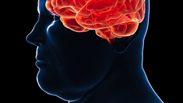 L'obesit&agrave; danneggia le funzioni cognitive