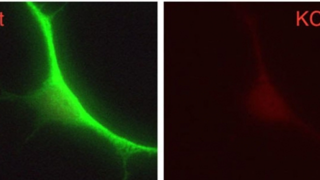 Neurone nella sindrome di Rett (Chen lab)