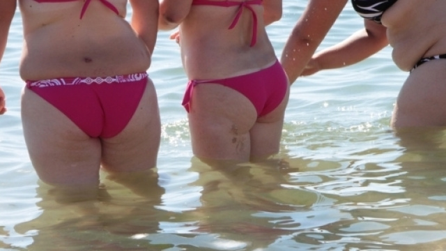 Su google &egrave; tra le domande pi&ugrave; richieste: 'La cellulite colpisce solo le donne?'