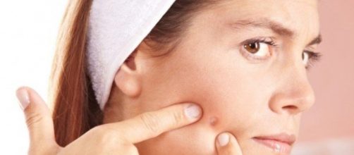 Imagem de uma mulher espremendo espinha.