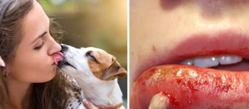 Lambidas de aninais de estima&ccedil;&atilde;o podem ser perigosas